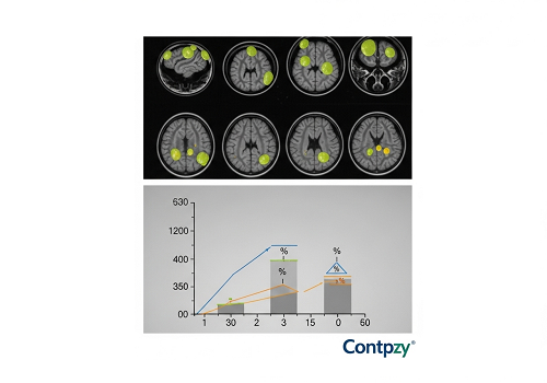 داروی آلزایمر مزایای غافلگیرکننده‌ای رو برای بعضی از بچه‌های مبتلا به اوتیسم نشون میده